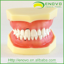 Modelo de diente peridontal suave extraíble dental EN-L3 para entrenamiento